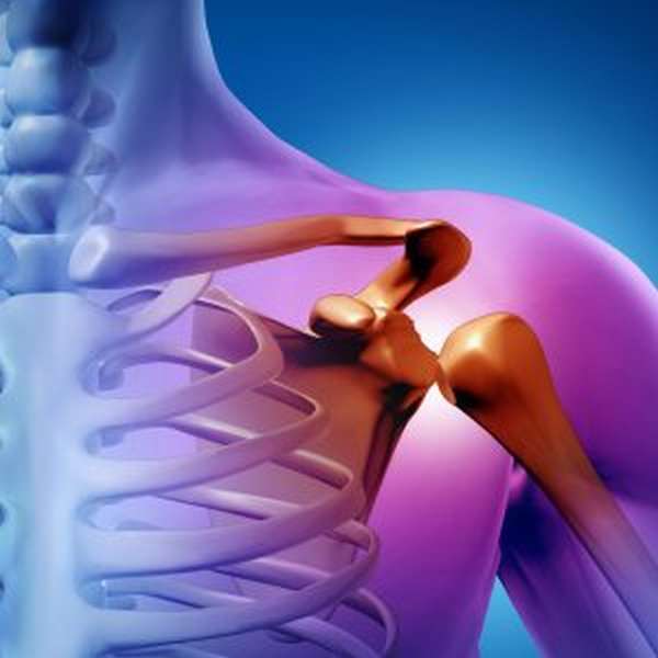Абдукционный перелом плечевой кости