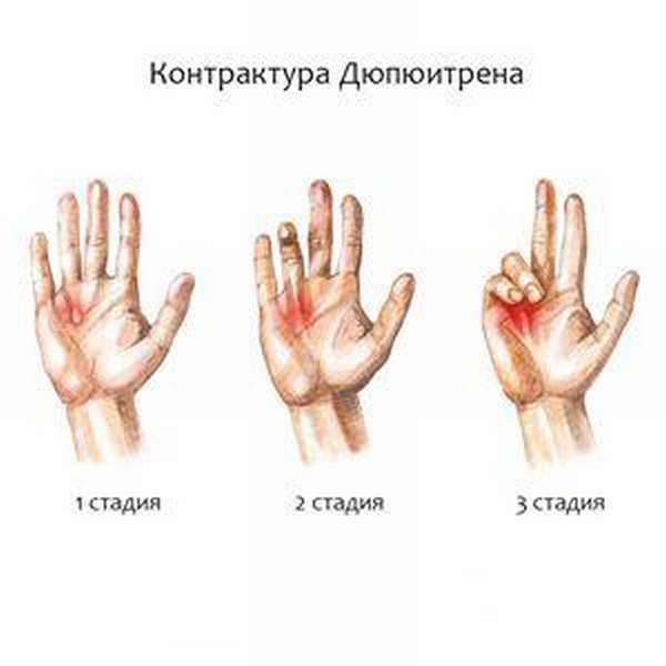 Растянутая кожа пальцев рук