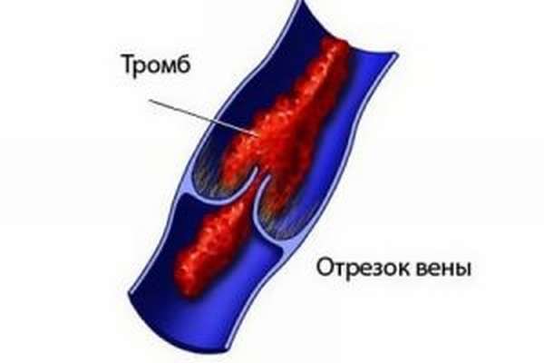Дуплексное сканирование вен и артерий
