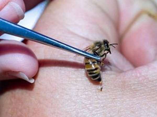 Пчелиный яд: польза и вред, что делать при укусе пчелы в домашних условиях
