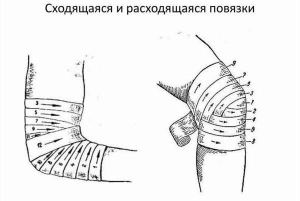 Какая повязка применяется при повреждении коленного сустава