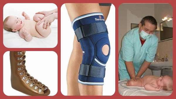 Рекурвация коленного сустава у взрослого лечение