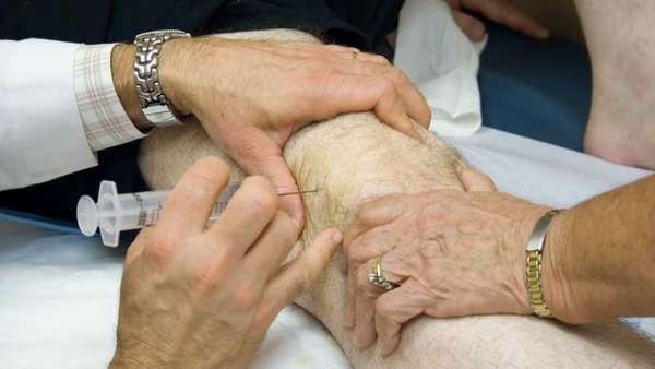 Гемартроз коленного сустава и его лечение народными средствами