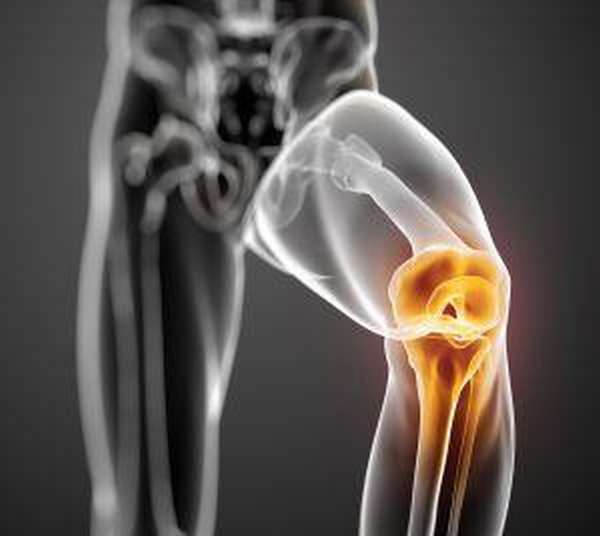 Как вылечить хондромаляция колена