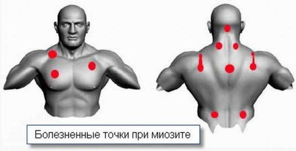 Отек грудных мышц у мужчин