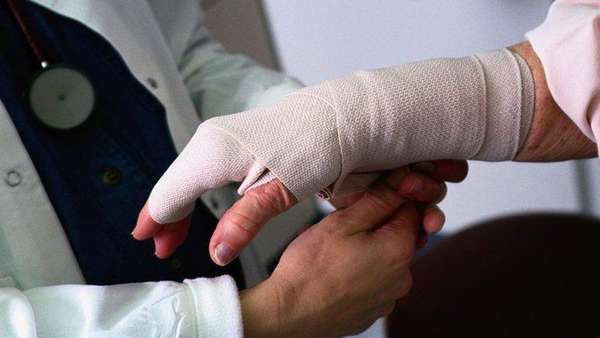 Что накладывают при переломе пальца руки