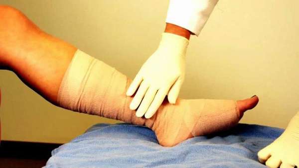 Ногтевой перелом большого пальца ноги лечение