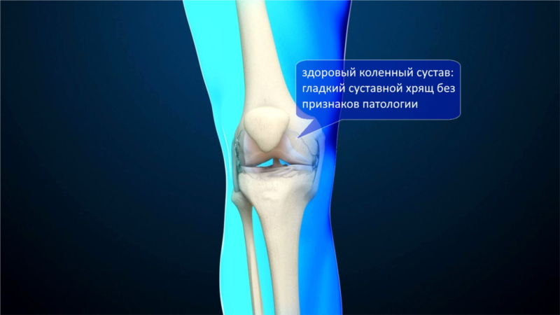 Что делать при вывихе коленный сустав