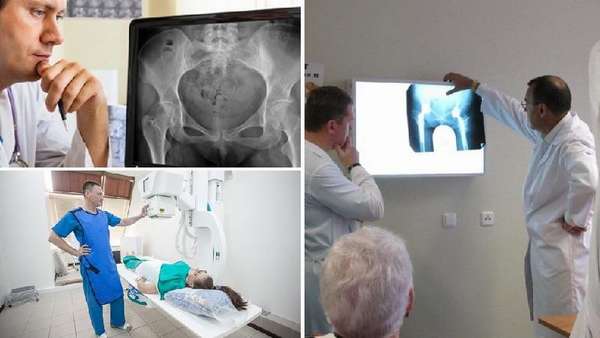Рентген тазобедренных суставов противопоказания