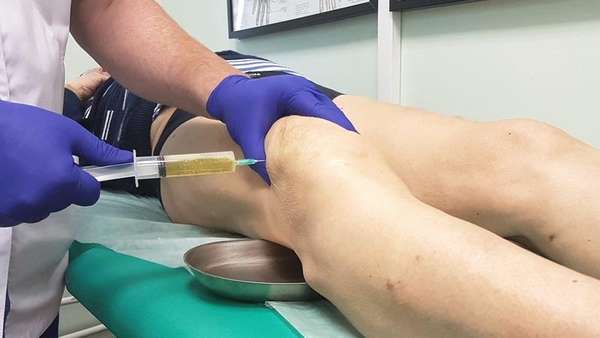 Синдром гусиной лапки коленного сустава лечение народными средствами