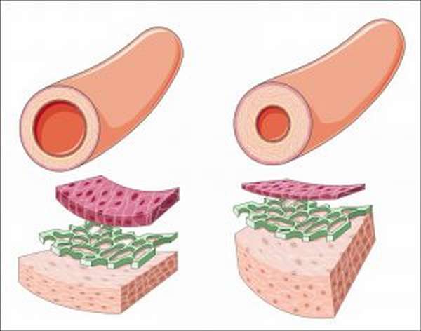 Дуплексное сканирование вен и артерий