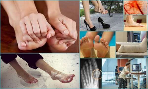 Лечить онемение ног пальцев при диабете 2 типа