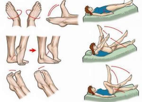 Упражнения при тромбофлебите ног