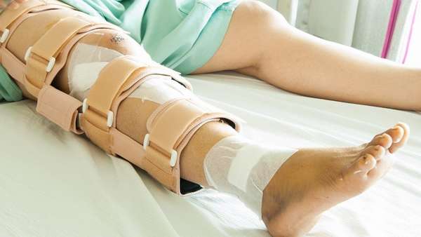Чем лечить переломы ног