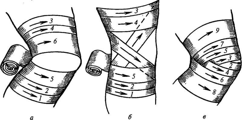 Алгоритм наложения повязки на коленный сустав