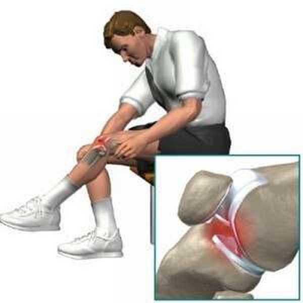 Воспаление мениска коленного сустава видео
