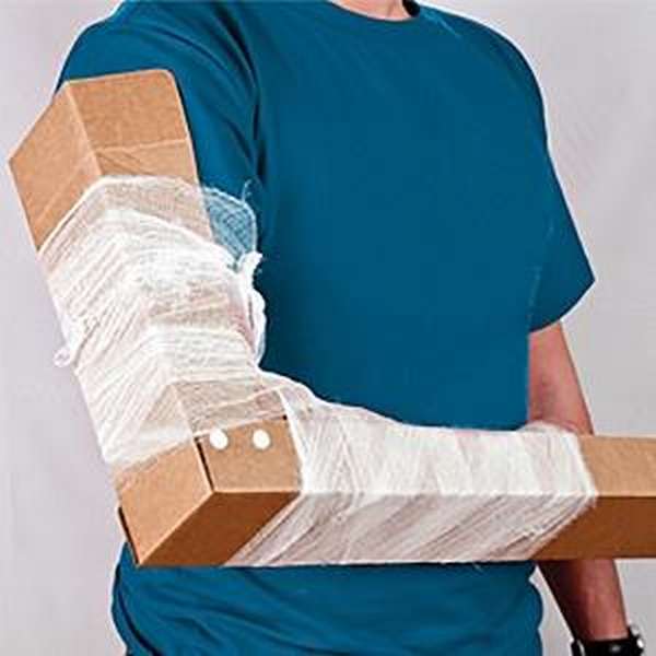 Реабилитация руки после перелома большого бугорка плечевой кости