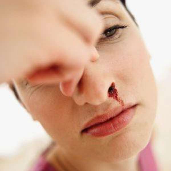 Репозиция костей носа противопоказания
