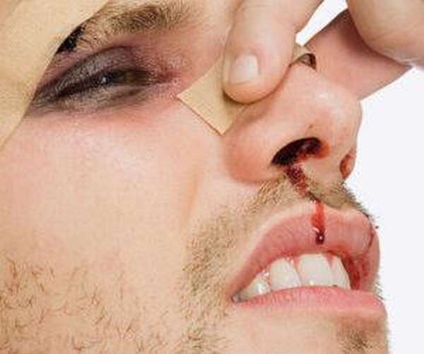 Вправление носа после перелома больно
