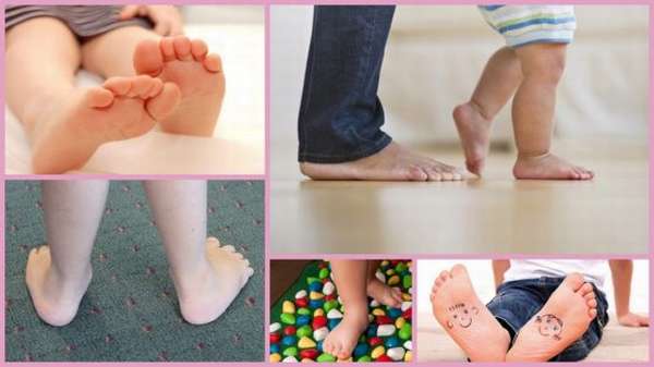 Как проверить плоскостопие у ребенка 2 года