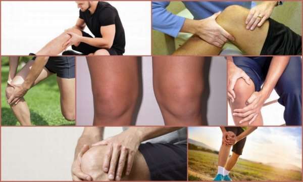 Лигаментоз крестообразных связок коленных. Лигаментит связок коленного сустава. Лигаментоз связок коленного сустава.