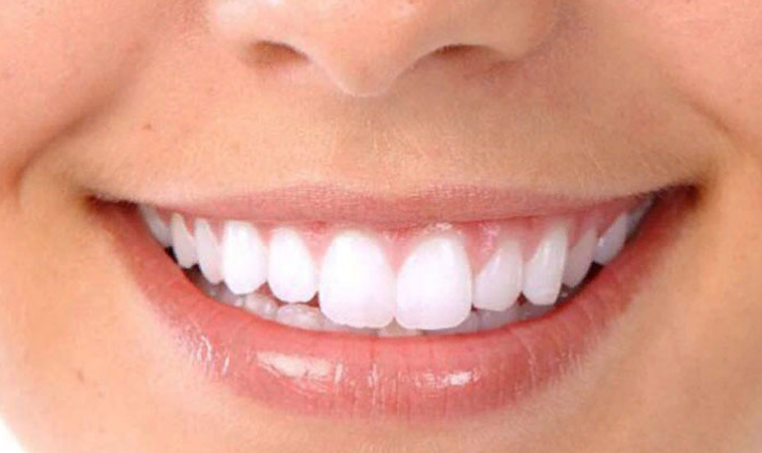 Топ-5 случаев, когда необходимо срочно обратиться к стоматологу